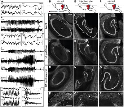 Differential vulnerability of neuronal subpopulations of the subiculum in a mouse model for mesial temporal lobe epilepsy